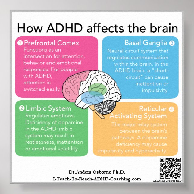 Poster Cérebro ADHD* (Frente)