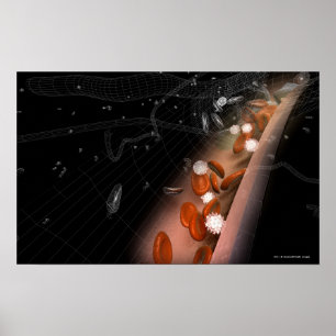 Póster Chapa nas artérias