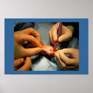 Poster Cirurgia pediatra da mão