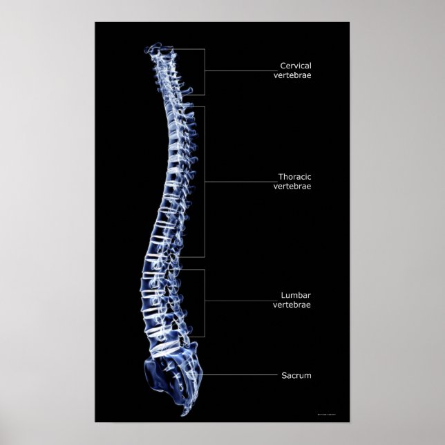Póster Coluna Vertebral 3 (Frente)