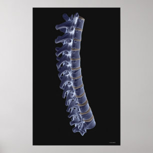 Poster Coluna Vertebral 3