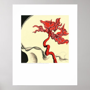 Póster Competição do cobrir - ArterioFlow-Árvore da vi
