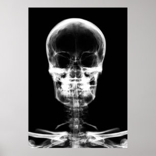 PÓSTER CRÂNIO DE ESQUELETO DA VISÃO DO RAIO X - B&W