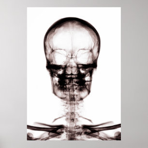 PÓSTER CRÂNIO DE ESQUELETO ORIG/NEGATIVE DA VISÃO DO RA