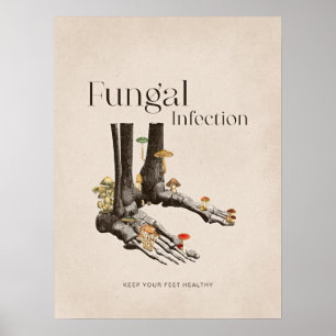 Poster Cuidado de Pé com Infecção Fungal Vintage