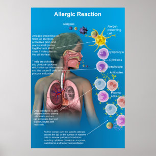 Poster da reação alérgica