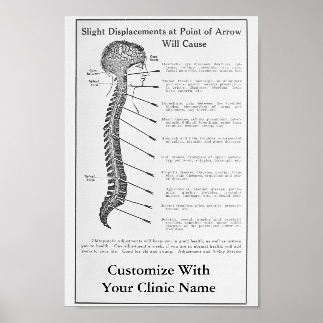 Poster de Arte da Chiropractic de 1921 (Frente)