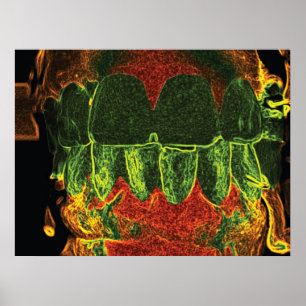 Poster de Dentista Ortodontista de dentada louca