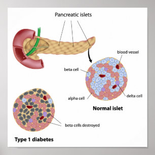 Poster de ilhotas pancreáticas e diabetes