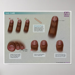 Poster de Medicina para Cuidados de unhas Melalogâ
