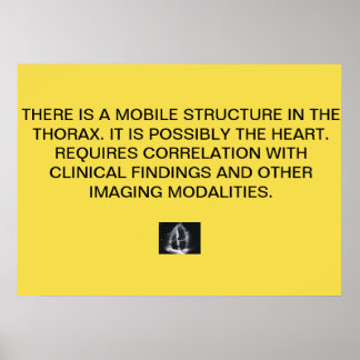 Poster de Relatório Echo Cardiac