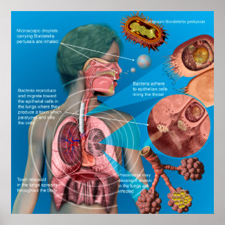 Poster de tosse convulsa