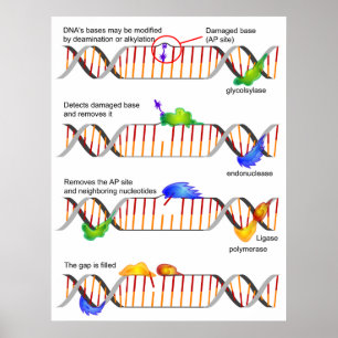 Poster Diagrama de um reparo baixo simples da excisão do