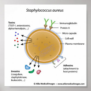 Póster Diagrama marcado pela bactéria Staphylococcus aure