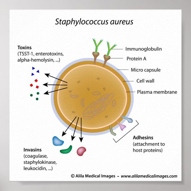 Póster Diagrama marcado pela bactéria Staphylococcus aure (Frente)