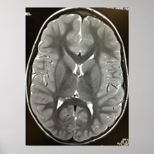 POSTER do Cérebro MRI