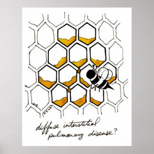 Poster Doença pulmonar intersticial difusa