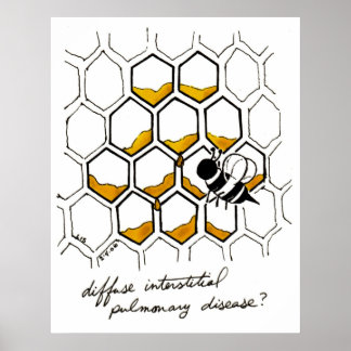 Poster Doença pulmonar intersticial difusa