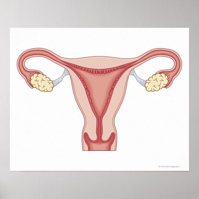Poster Doenças dos órgãos genitais femininos 2 (Frente)