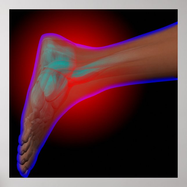 Póster Dor no Ankle (Frente)