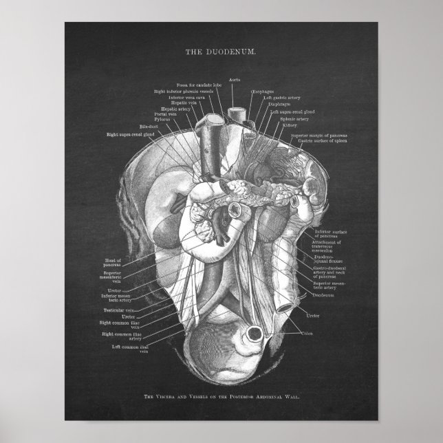 Poster Duodeno Anatomia Arte Gastroenterologista Decor de (Frente)