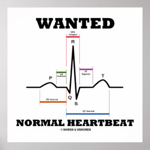 Póster Eletrocardiograma com pulsação normal desejada ECG