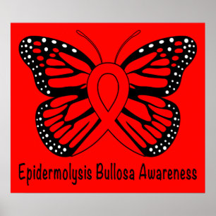 Poster Epidermolysis Bullosa (EB)
