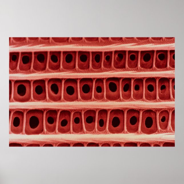 Poster Escala de asas (Frente)