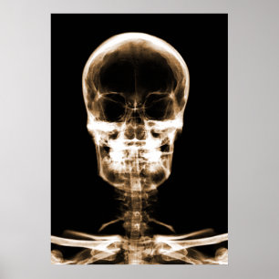 PÓSTER ESQUELETÃO DE VISÃO X-RAY - LARANJA