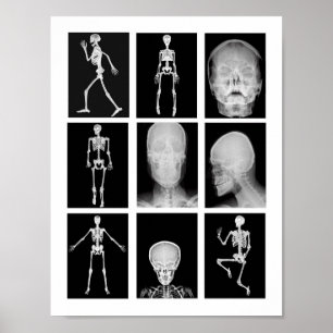 Poster esqueleto Caveira Corpo Humano XRAYS Arte de colag