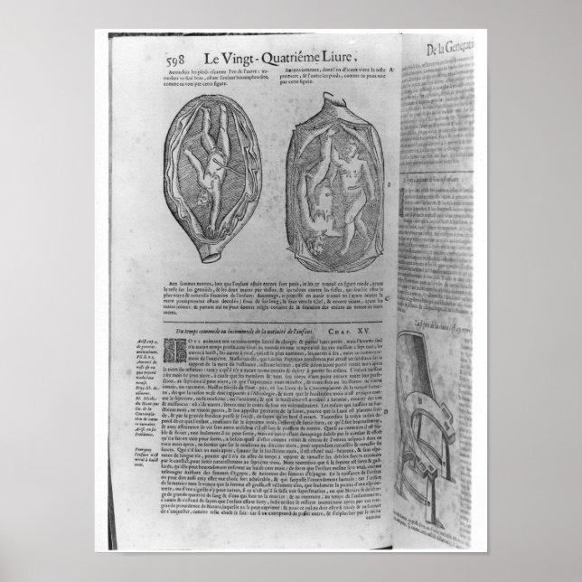 Póster Feto, ilustração de "Oeuvres" (Frente)