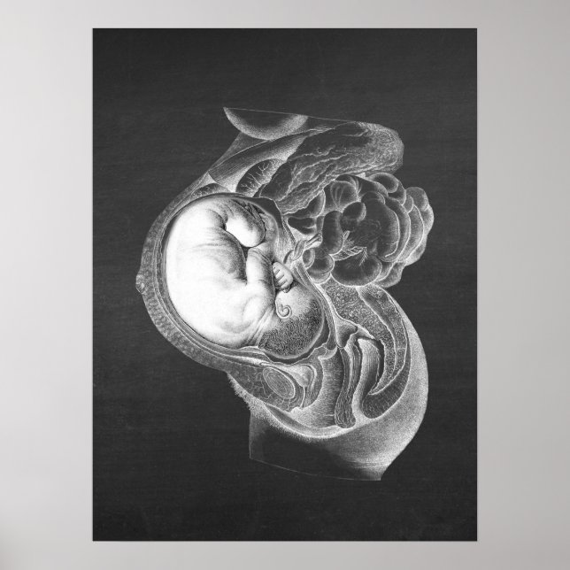 Poster Fetus Womb Anatomy Obstetrics Decor n. º 2 (Frente)