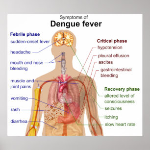 Poster Figura dos principais sintomas da febre de dengue