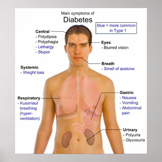 Póster Figura dos principais sintomas de diabetes no ser  (Frente)