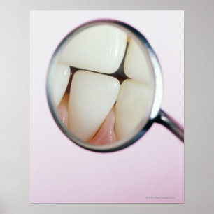Póster Fim-acima dos dentes refletidos no espelho dental