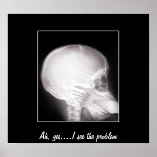 Póster Foto em raio-X da boca