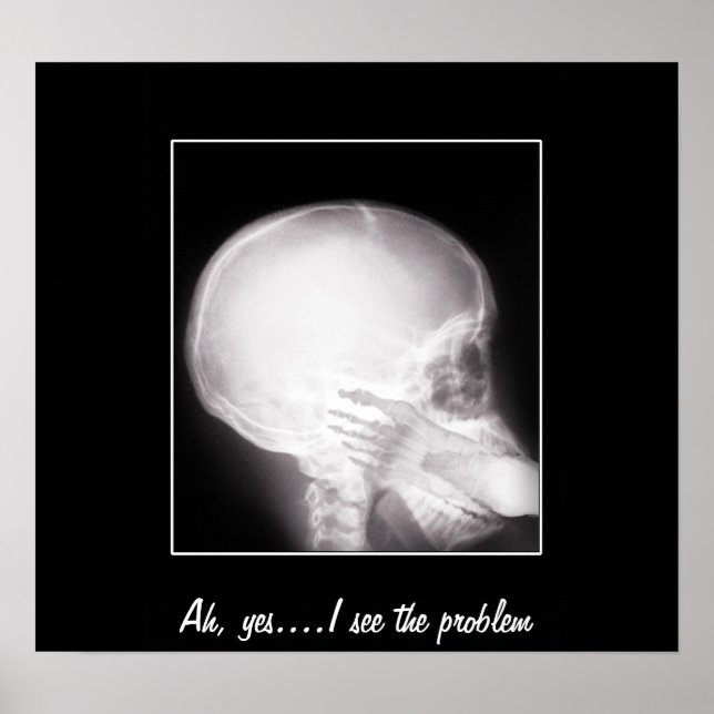 Póster Foto em raio-X da boca (Frente)