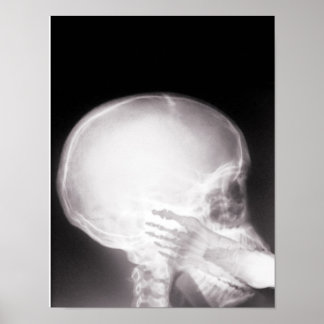 Póster Foto em raio-X da boca