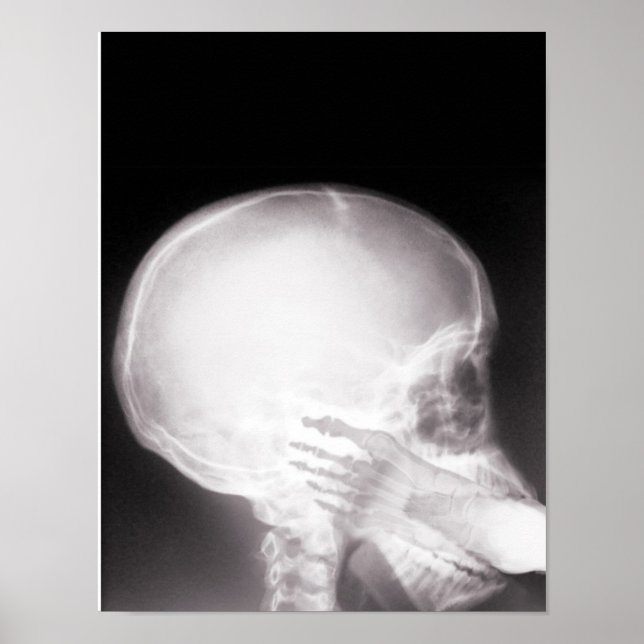 Póster Foto em raio-X da boca (Frente)