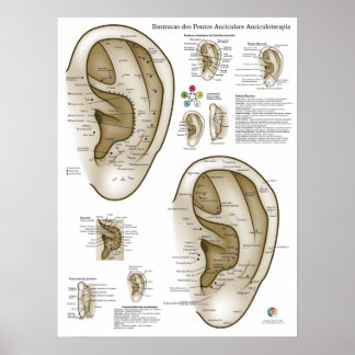 Poster Gráfico de Acupuntura Auricular Espanhol