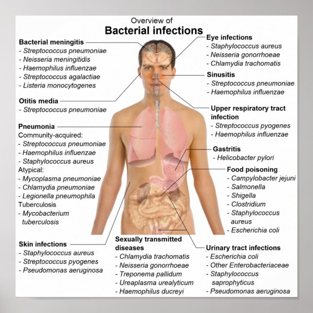 Poster Gráfico de infecções bacterianas em seres h (Frente)