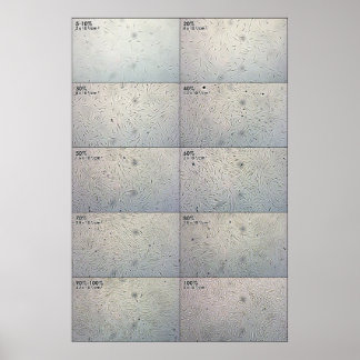 Póster Gráfico de seguimento da influência