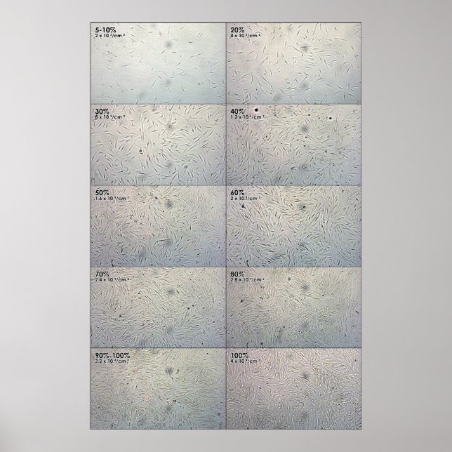 Póster Gráfico de seguimento da influência (Frente)