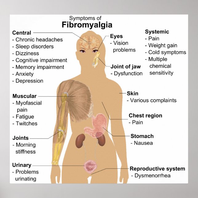 Póster Gráfico dos Sintomas da Fibromialgia (Frente)