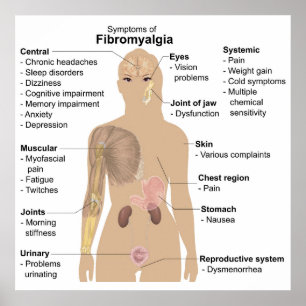 Poster Gráfico Sinais Comuns + Sintomas Fibromialgia Post