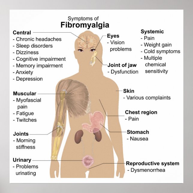 Poster Gráfico Sinais Comuns + Sintomas Fibromialgia Post (Frente)