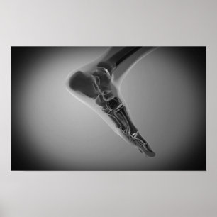 Poster Ideia do raio X do pé humano 4