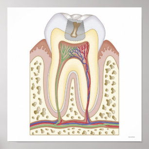 Póster Ilustração do Decaimento dos Dentes