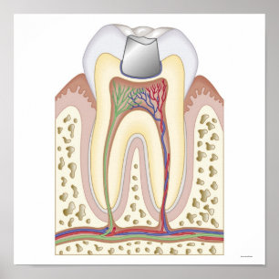 Poster Ilustração do enchimento dental