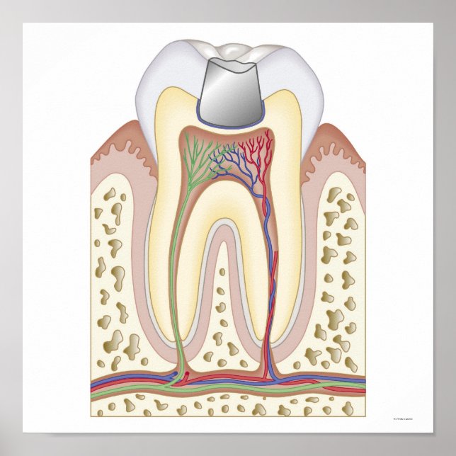 Poster Ilustração do preenchimento dentário (Frente)